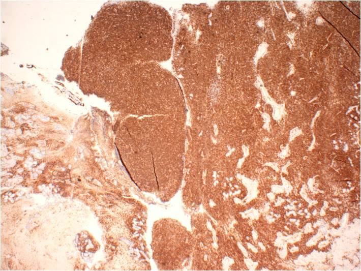 Figure 8a. CD123, 4x